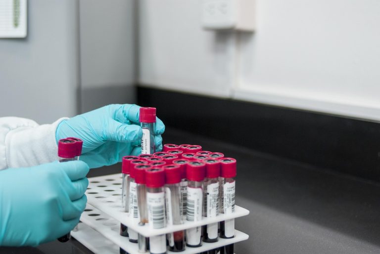 Orchid Pharma Exblifep: gloved hand placing a sample tube in a hospital laboratory rack